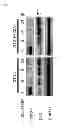 Fig. 04 - Method of treating ischemia/reperfusion injury