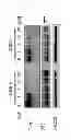 Fig. 06 - Method of treating ischemia/reperfusion injury