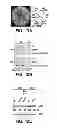 Fig. 10 - Selective reduction of the deleterious activity of extended tri-nucleotide repeat containing genes