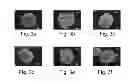 Fig. 05 - AGENTS, COMPOSITIONS AND METHODS FOR TREATING PATHOLOGIES IN WHICH REGULATING AN ACHE-ASSOCIATED BIOLOGICAL PATHWAY IS BENEFICIAL