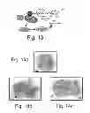Fig. 16 - AGENTS, COMPOSITIONS AND METHODS FOR TREATING PATHOLOGIES IN WHICH REGULATING AN ACHE-ASSOCIATED BIOLOGICAL PATHWAY IS BENEFICIAL