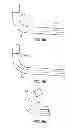 Fig. 09 - DEVICES, METHODS, AND SYSTEMS FOR DELIVERING IMPLANTS TO A LUNG REGION