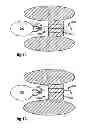 Fig. 08 - Retraction of tissue for single port entry, robotically assisted medical procedures