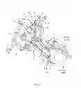 Fig. 02 - Surgical access system and related methods