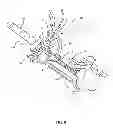 Fig. 09 - Surgical access system and related methods