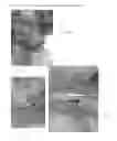 Fig. 06 - ACTUATABLE RETRACTOR