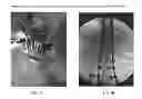 Fig. 07 - ACTUATABLE RETRACTOR