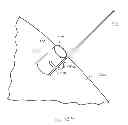 Fig. 22 - ACTUATABLE RETRACTOR