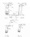 Fig. 30 - ACTUATABLE RETRACTOR