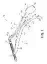 Fig. 02 - Spreading retractor
