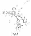 Fig. 06 - Spreading retractor