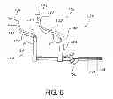 Fig. 07 - Spreading retractor