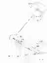 Fig. 03 - Vibrating Comedo Extractor with Light