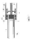 Fig. 17 - DECOMPRESSION MECHANISM, PUNCTURING APPARATUS, AND BLOOD ANALYSIS APPARATUS