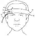 Fig. 01 - Medical sensor with compressible light barrier and technique for using the same