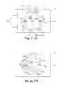 Fig. 03 - Monte carlo and iterative methods for determination of tissue oxygen saturation