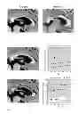Fig. 04 - Method and system for processing MRT data of the human brain