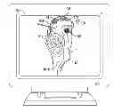 Fig. 01 - Soft tissue cutting instrument and method of use