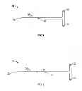 Fig. 03 - Soft tissue cutting instrument and method of use
