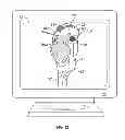 Fig. 12 - Soft tissue cutting instrument and method of use