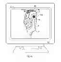 Fig. 13 - Soft tissue cutting instrument and method of use