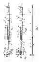 Fig. 02 - Guide wire for use with a catheter