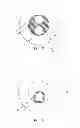 Fig. 07 - Control catheters and methods for pulmonary suffusion and related therapies