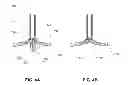 Fig. 05 - METHODS, DEVICES AND SYSTEMS FOR APPROXIMATION AND FASTENING OF SOFT TISSUE
