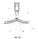 Fig. 09 - METHODS, DEVICES AND SYSTEMS FOR APPROXIMATION AND FASTENING OF SOFT TISSUE