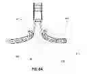 Fig. 10 - METHODS, DEVICES AND SYSTEMS FOR APPROXIMATION AND FASTENING OF SOFT TISSUE