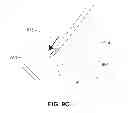 Fig. 14 - METHODS, DEVICES AND SYSTEMS FOR APPROXIMATION AND FASTENING OF SOFT TISSUE
