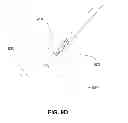 Fig. 15 - METHODS, DEVICES AND SYSTEMS FOR APPROXIMATION AND FASTENING OF SOFT TISSUE