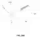 Fig. 19 - METHODS, DEVICES AND SYSTEMS FOR APPROXIMATION AND FASTENING OF SOFT TISSUE