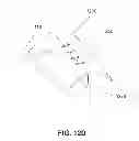Fig. 24 - METHODS, DEVICES AND SYSTEMS FOR APPROXIMATION AND FASTENING OF SOFT TISSUE