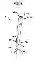 Fig. 02 - Methods and devices for spinal fixation element placement
