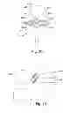 Fig. 06 - METHODS FOR STIMULATING THE DORSAL ROOT GANGLION WITH A LEAD HAVING SEGMENTED ELECTRODES