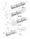 Fig. 07 - METHODS FOR STIMULATING THE DORSAL ROOT GANGLION WITH A LEAD HAVING SEGMENTED ELECTRODES