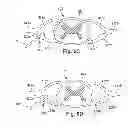 Fig. 10 - METHODS FOR STIMULATING THE DORSAL ROOT GANGLION WITH A LEAD HAVING SEGMENTED ELECTRODES