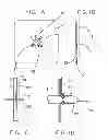 Fig. 02 - Medical device ameneable to fenestration