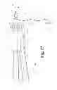 Fig. 14 - System for stabilizing a portion of the spine