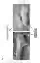 Fig. 04 - Novel Inflammation to vivo model