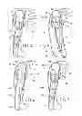Fig. 04 - Bicycle shift operating device
