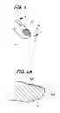 Fig. 02 - DURABLE SPARKLING FINGERNAIL COATING AND METHOD OF FABRICATION THEREFOR