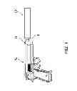 Fig. 02 - Sound suppressor for firearms