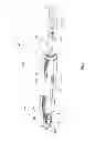 Fig. 02 - High power laser offshore decommissioning tool, system and methods of use
