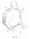 Fig. 07 - SEPARATING TYPE BACKPACK