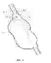 Fig. 09 - SEPARATING TYPE BACKPACK