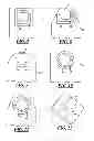 Fig. 04 - Spark plug having a thin noble metal firing pad
