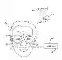 Fig. 01 - Disruption of facial recognition system