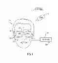Fig. 02 - Disruption of facial recognition system